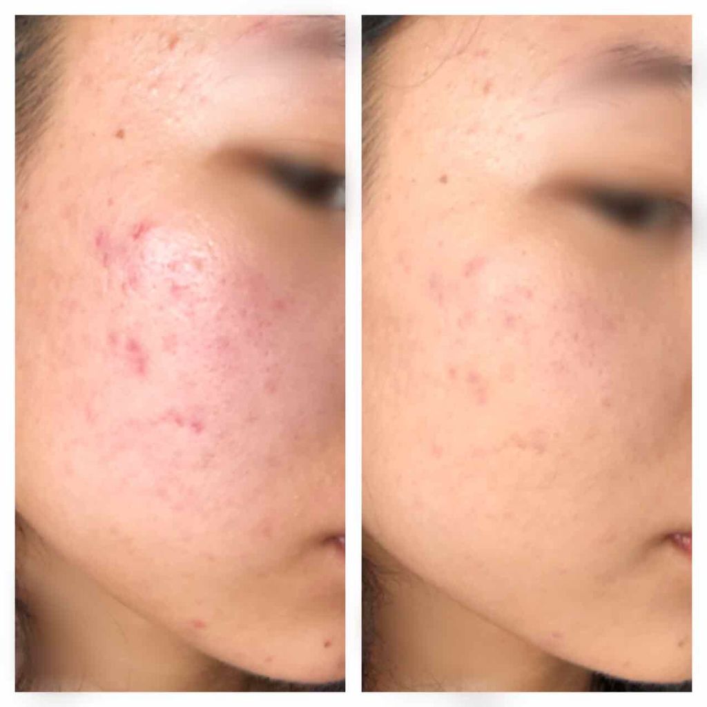 SP クッション ウルトラカバークッション BB/MAYBELLINE NEW YORK/クッションファンデーションを使ったクチコミ(2枚目)