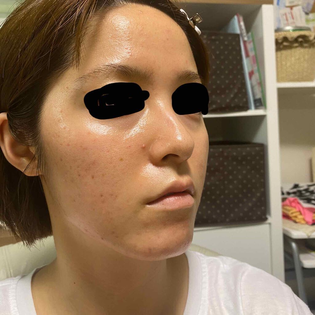 DHC ビタミンCハードカプセル/DHC/美容サプリメントを使ったクチコミ(2枚目)