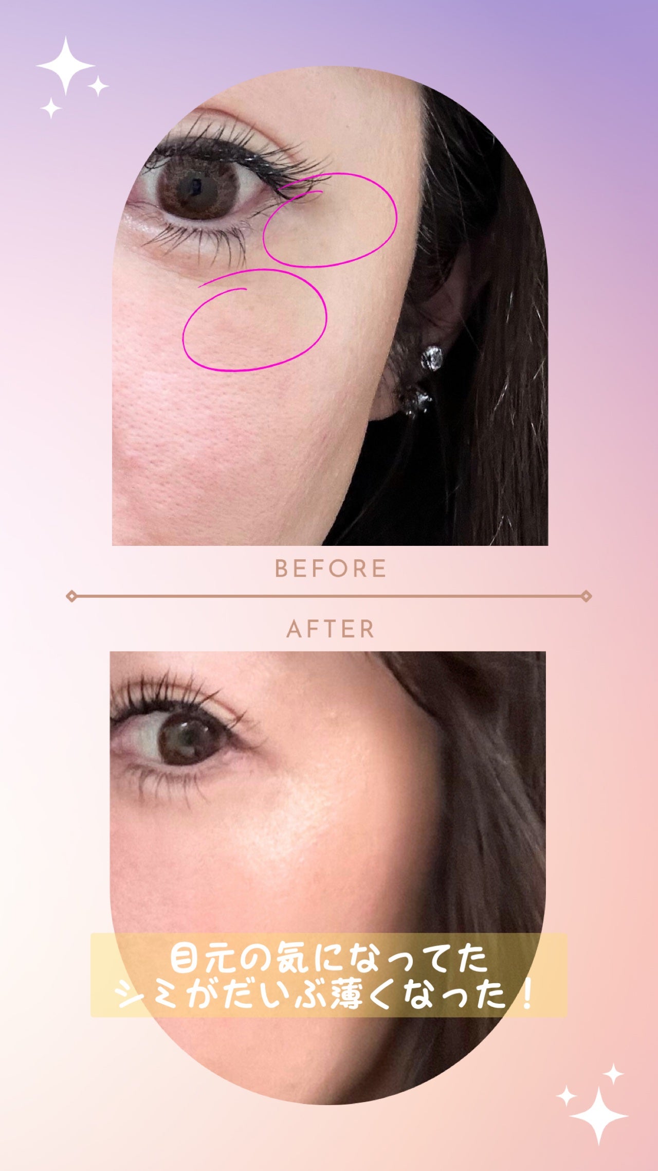 メリタンショットガン/セルオロジー/美顔器・マッサージを使ったクチコミ(3枚目)