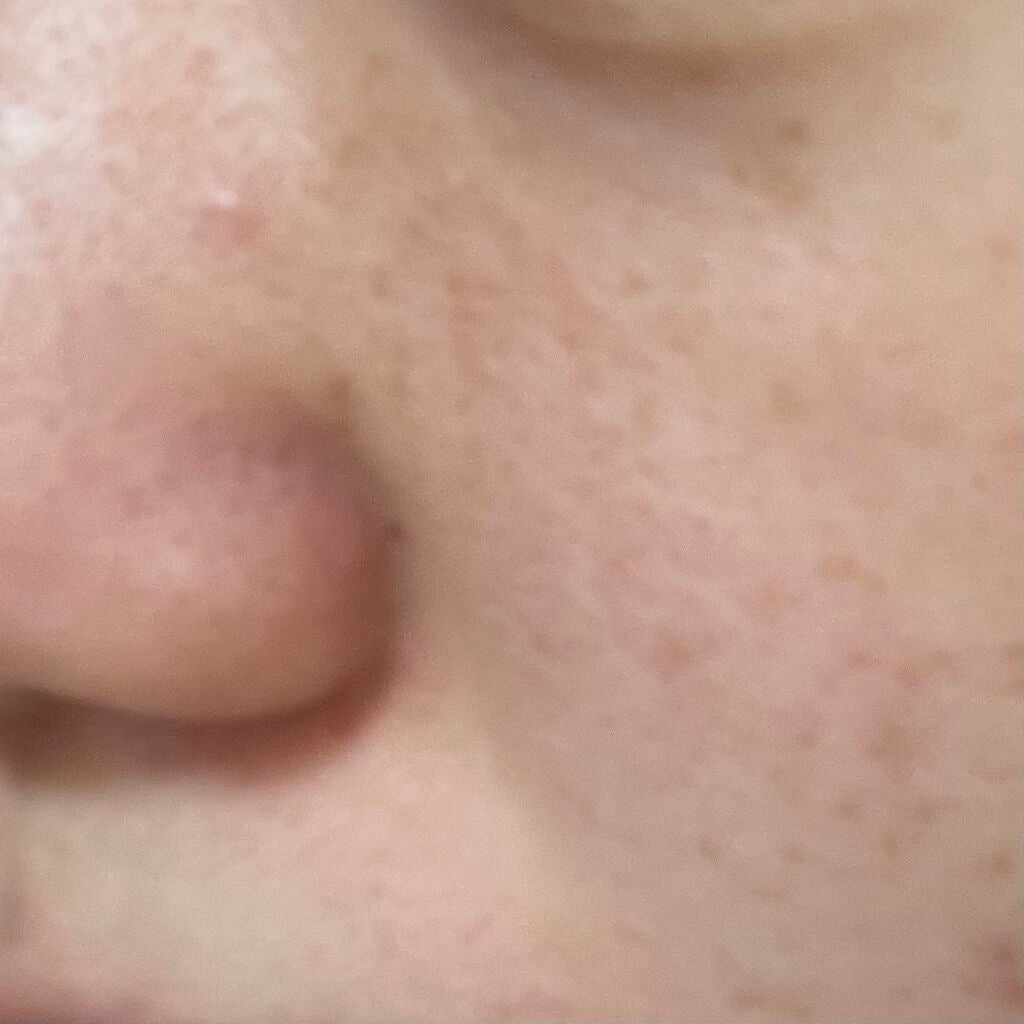 毛穴すっきりクレイパック/ボタニカルフォース/洗い流すパック・マスクを使ったクチコミ(2枚目)