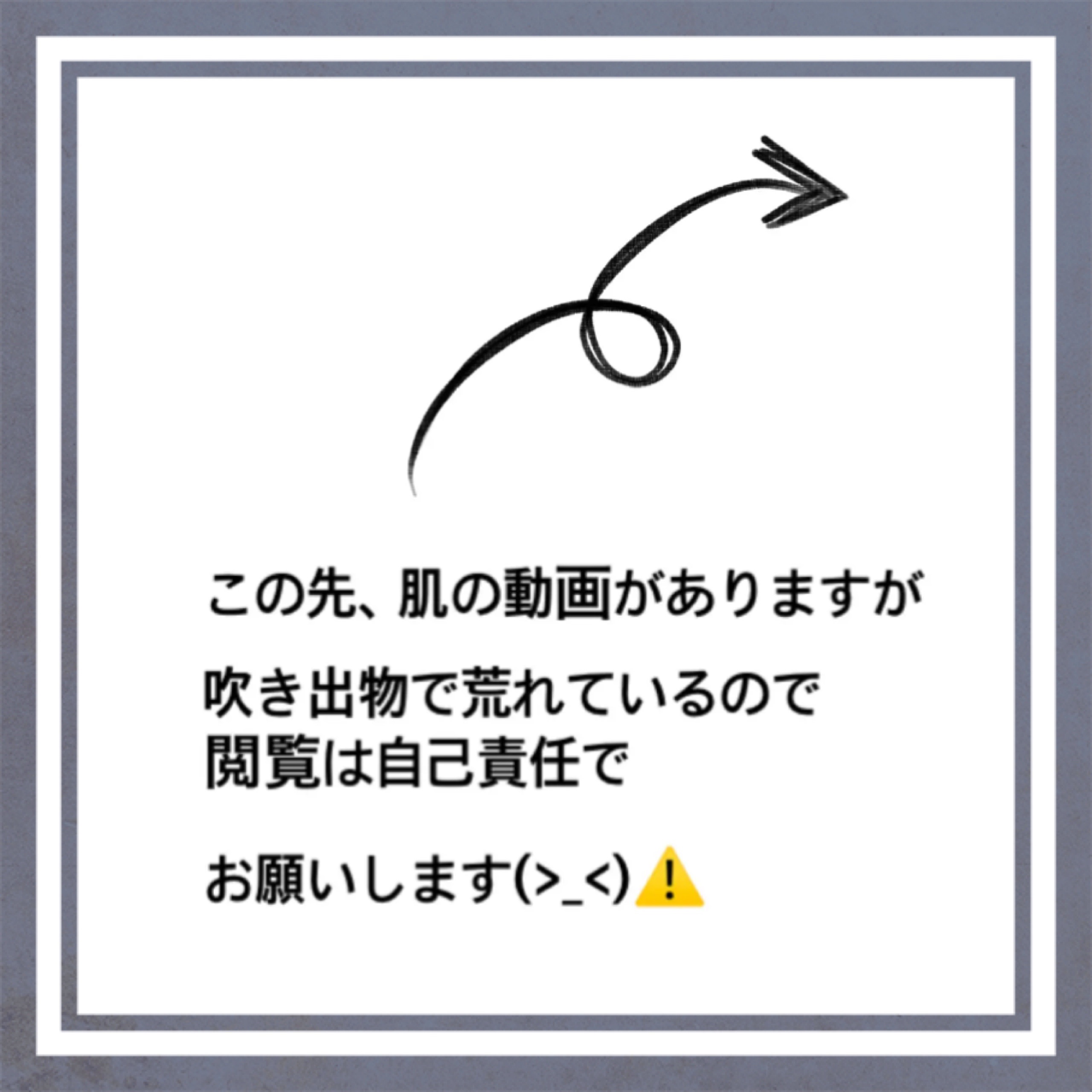 トーニング ローション SP ドライ／ノーマル/CLARINS/化粧水を使ったクチコミ（2枚目）