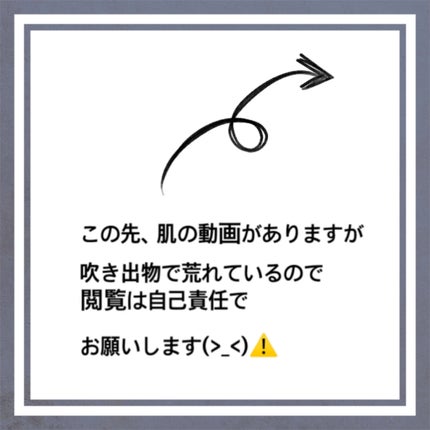 原液ピーリング液/TUNEMAKERS/拭き取り化粧水を使ったクチコミ(2枚目)