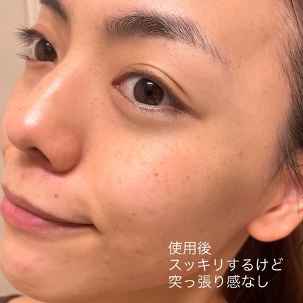 モッチスキン吸着クレンジングBK(炭)/MoccHi SKIN/クレンジングジェルを使ったクチコミ(5枚目)