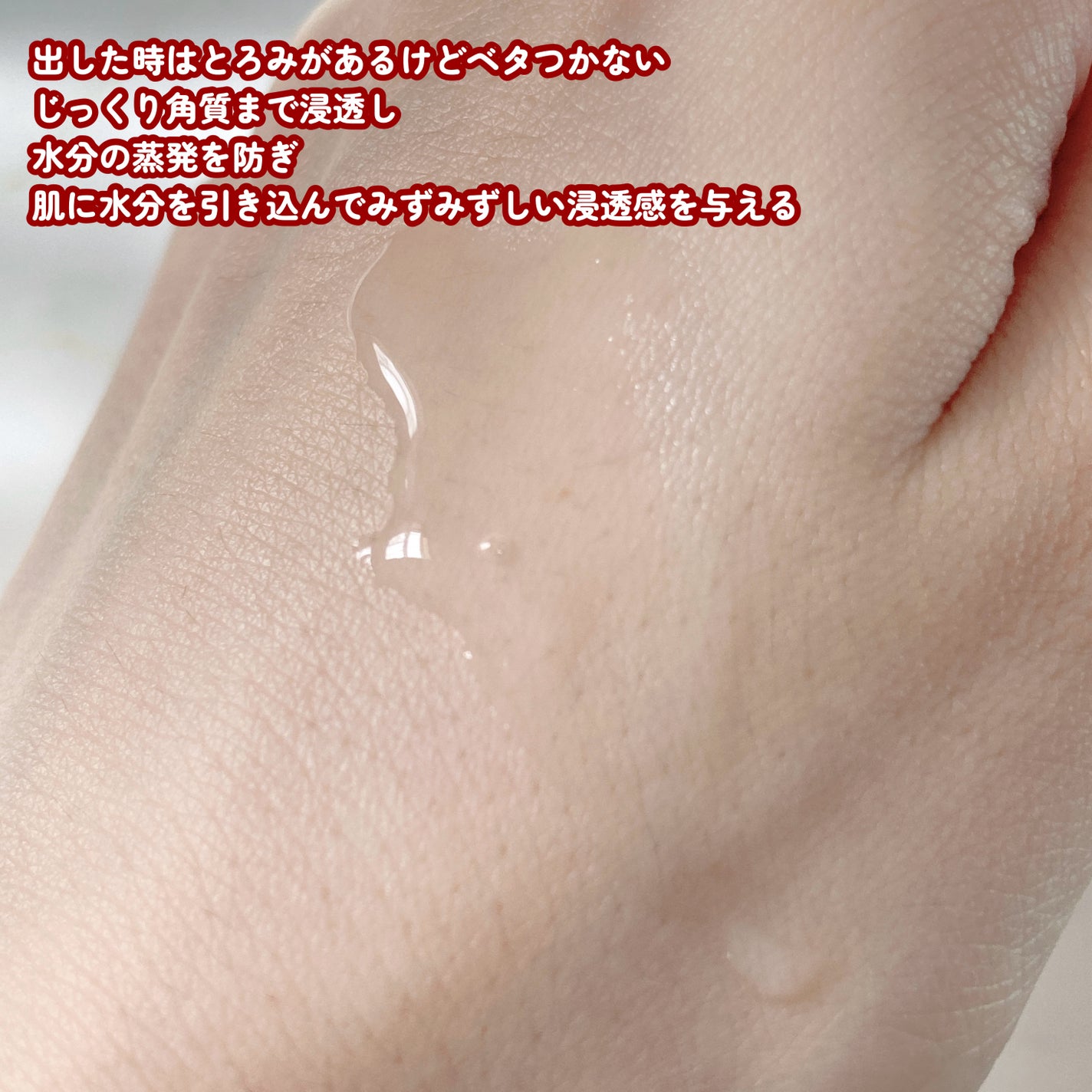 オイデルミン エッセンスローション/SHISEIDO/化粧水を使ったクチコミ(2枚目)