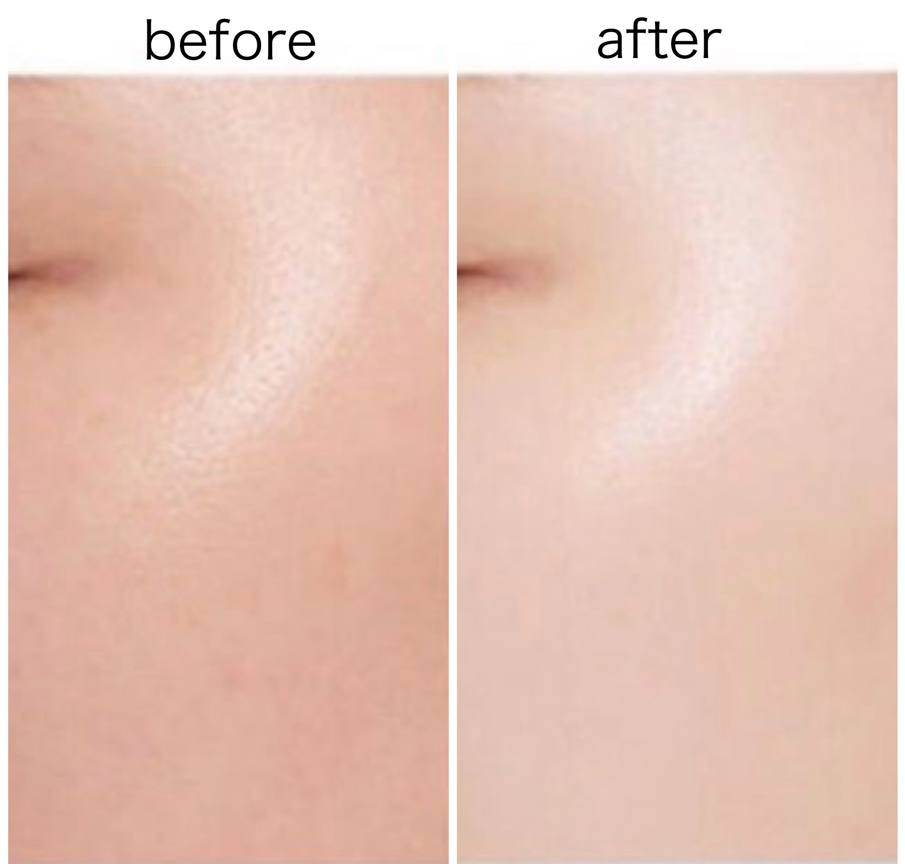 ユース ラディアンス ビタチノール セラム/primera/美容液を使ったクチコミ（3枚目）