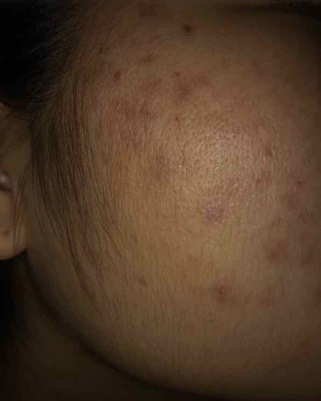 ハトムギ化粧水(ナチュリエ スキンコンディショナー R )/ナチュリエ/化粧水を使ったクチコミ（3枚目）