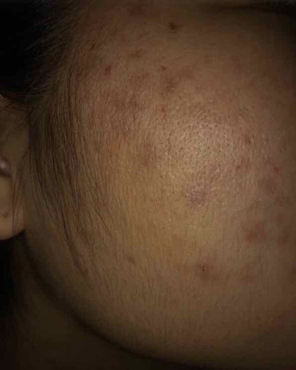 ハトムギ化粧水(ナチュリエ スキンコンディショナー R )/ナチュリエ/化粧水を使ったクチコミ(3枚目)