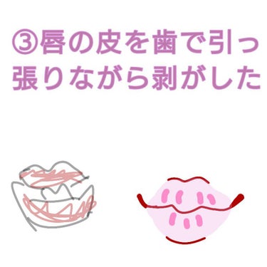 こーど on LIPS 「こんにちは！こーどです。今回は私の唇についてです。今日友達に唇..」（5枚目）