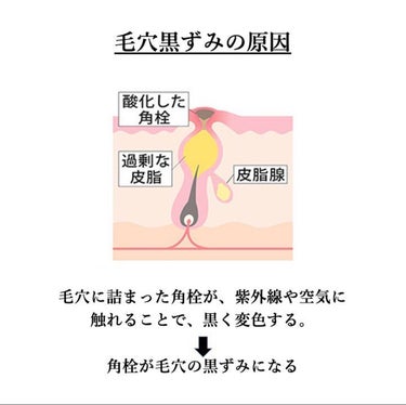 ミノン アミノモイスト 薬用アクネケア ミルク/ミノン/乳液を使ったクチコミ（2枚目）