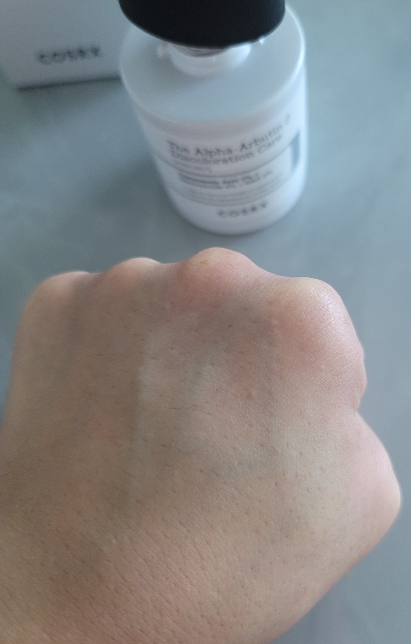 RXザ・アルファアルブチン2 ニキビ跡ケアセラム/COSRX/美容液を使ったクチコミ(4枚目)