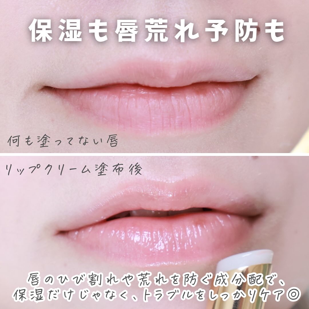 ＆be 薬用モイストリップケア【医薬部外品】/＆be/リップクリームを使ったクチコミ（3枚目）