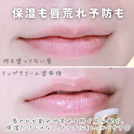 &be 薬用モイストリップケア【医薬部外品】/&be/リップクリームを使ったクチコミ(3枚目)