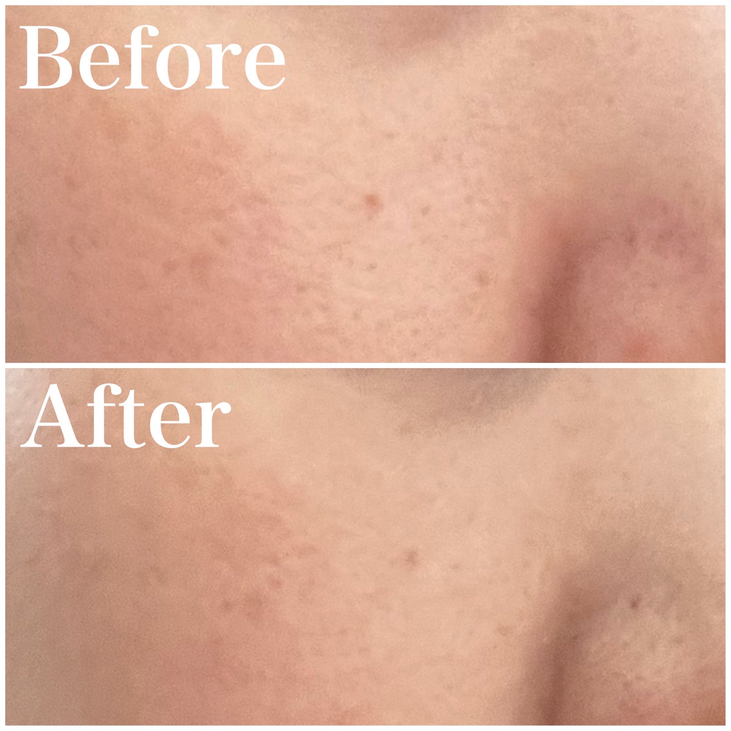 プロフィニッシュファンデーション/インテグレート/パウダーファンデーションを使ったクチコミ(4枚目)