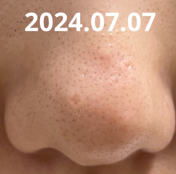 ムースネトワイアントCn/クレ・ド・ポー ボーテ/洗顔フォームを使ったクチコミ（3枚目）