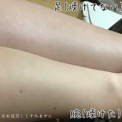 みっちぇ on LIPS 「😭焼けた肌を白くしたい😭十代の頃は勝手に元に戻ってた日焼けの肌..」(2枚目)