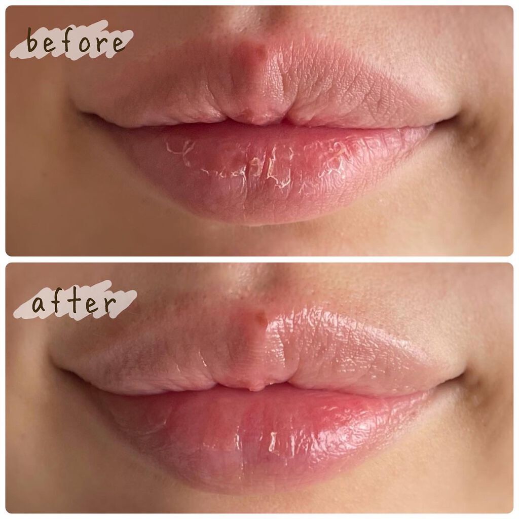 ユニコーングッドナイトリップマスク カカドゥプラム/SELF BEAUTY/リップマスクを使ったクチコミ(4枚目)