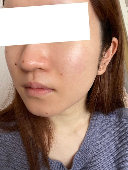 スンジョン バーム/ETUDE/フェイスバームを使ったクチコミ(4枚目)