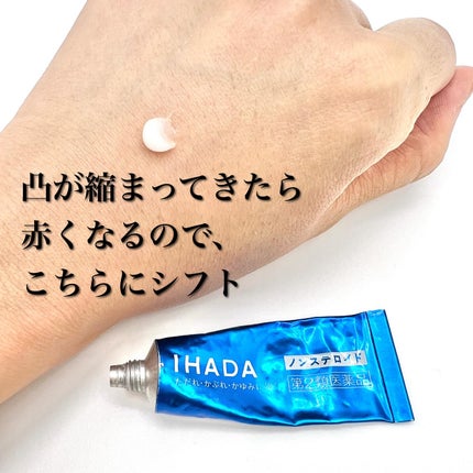 ペアアクネクリームW(医薬品)/ペア/その他を使ったクチコミ(4枚目)