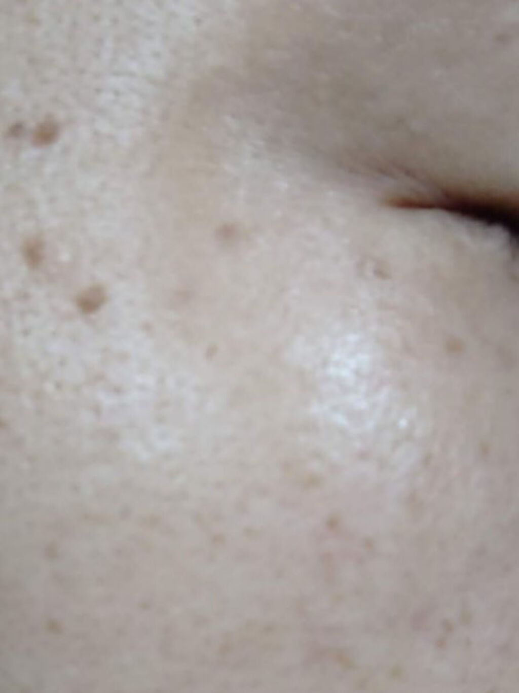 ブライトニングフォーミュラ/メコゾーム/フェイスクリームを使ったクチコミ(2枚目)