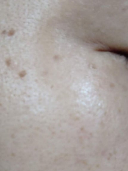 ブライトニングフォーミュラ/メコゾーム/フェイスクリームを使ったクチコミ(2枚目)