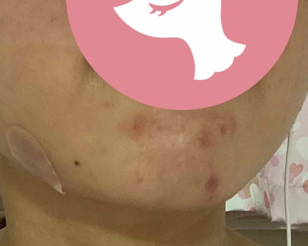 AC トライアルセット/NOV/トライアルキットを使ったクチコミ（2枚目）