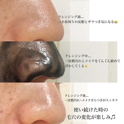 riko on LIPS 「肌悩みに合わせて選べるサンドラッグのクレンジングバーム知ってる..」(4枚目)