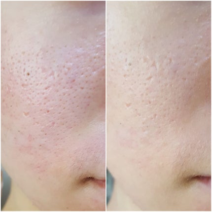 ぎんむぎ@フォロバするお👍🏻🎀 on LIPS 「【ひと塗りで素肌のような💞透明肌💞を手に入れられるBBクリーム..」(2枚目)