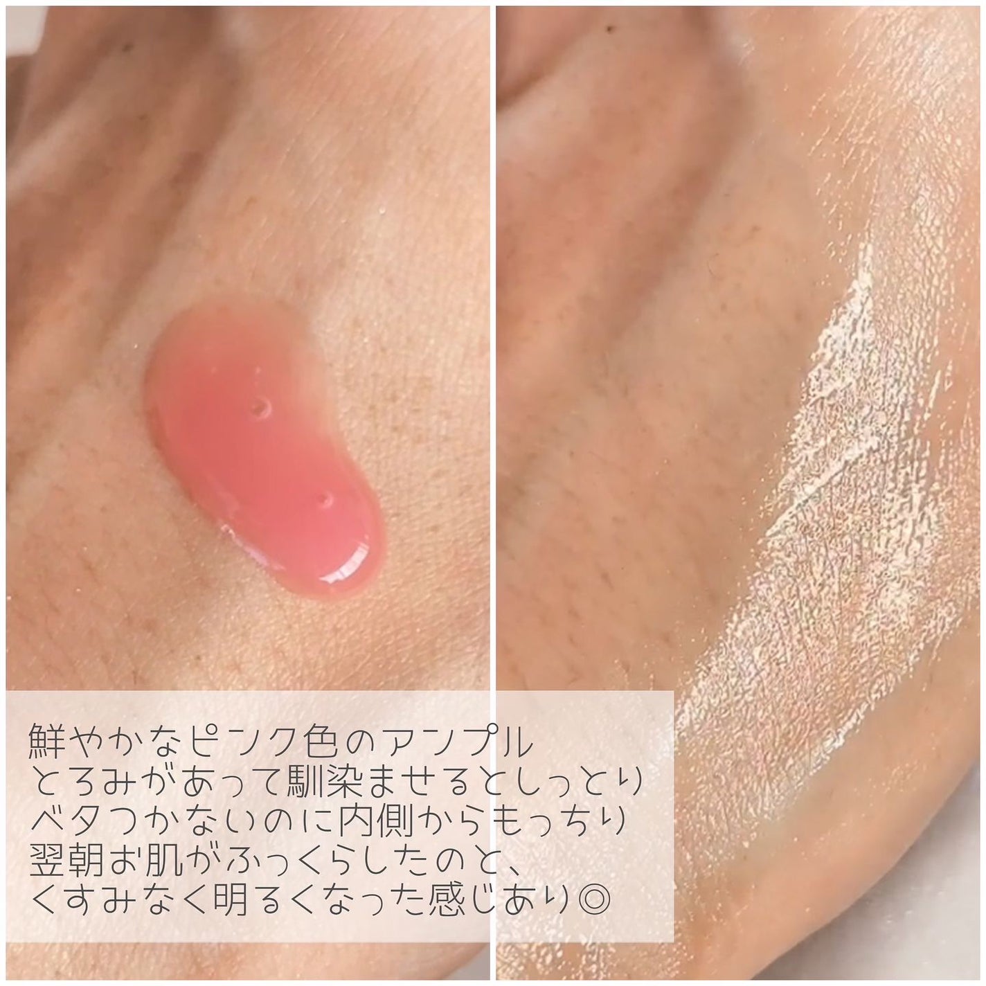 PDRNピンクアンプル PDRN 10,000ppm配合/MEDICUBE/美容液を使ったクチコミ(3枚目)