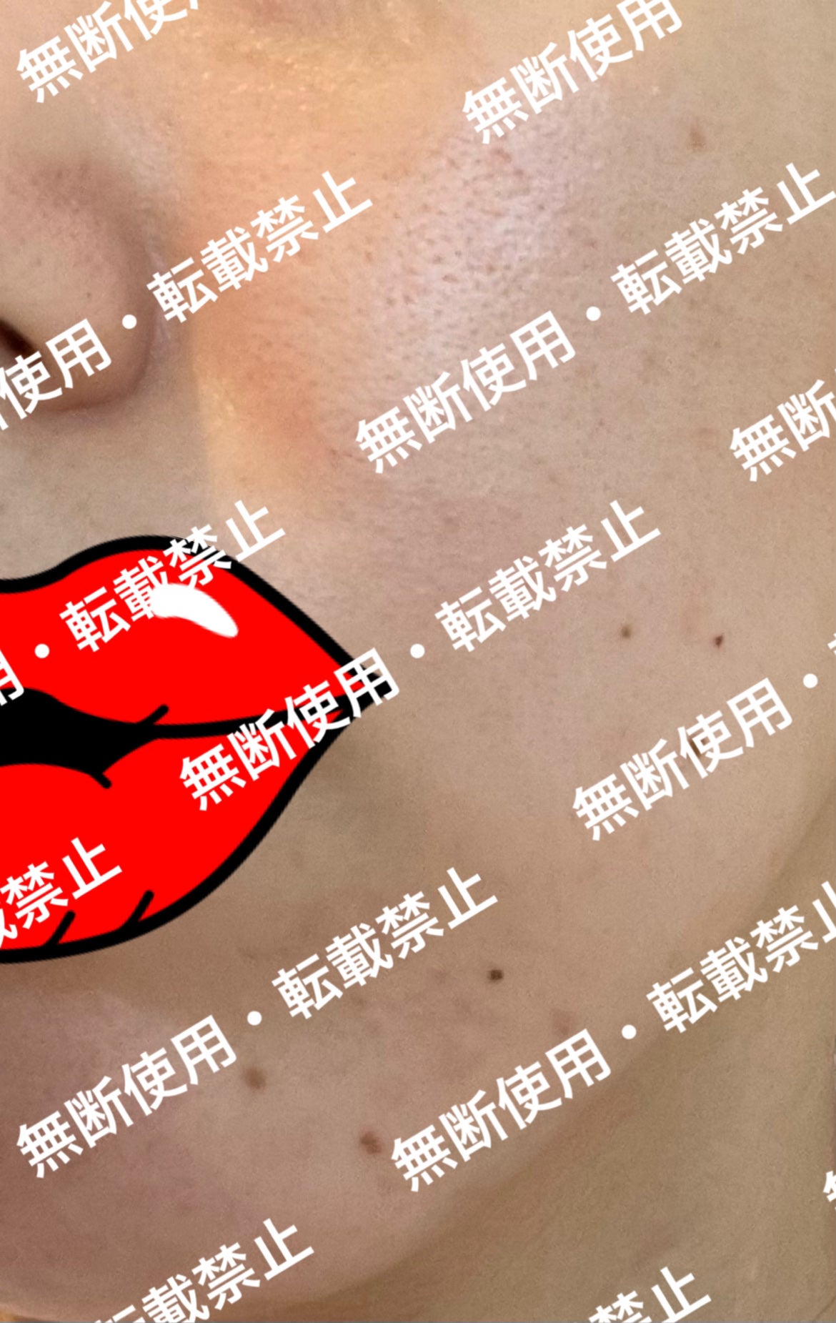 VC ホワイトピールセラム/SKIO/ブースター・導入液を使ったクチコミ(7枚目)