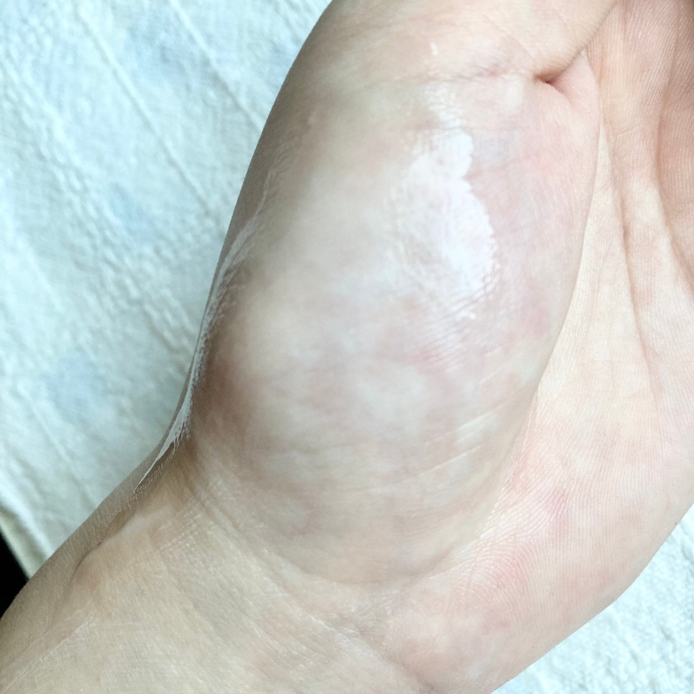 アトクリーム/TAGA/その他スキンケアを使ったクチコミ(4枚目)