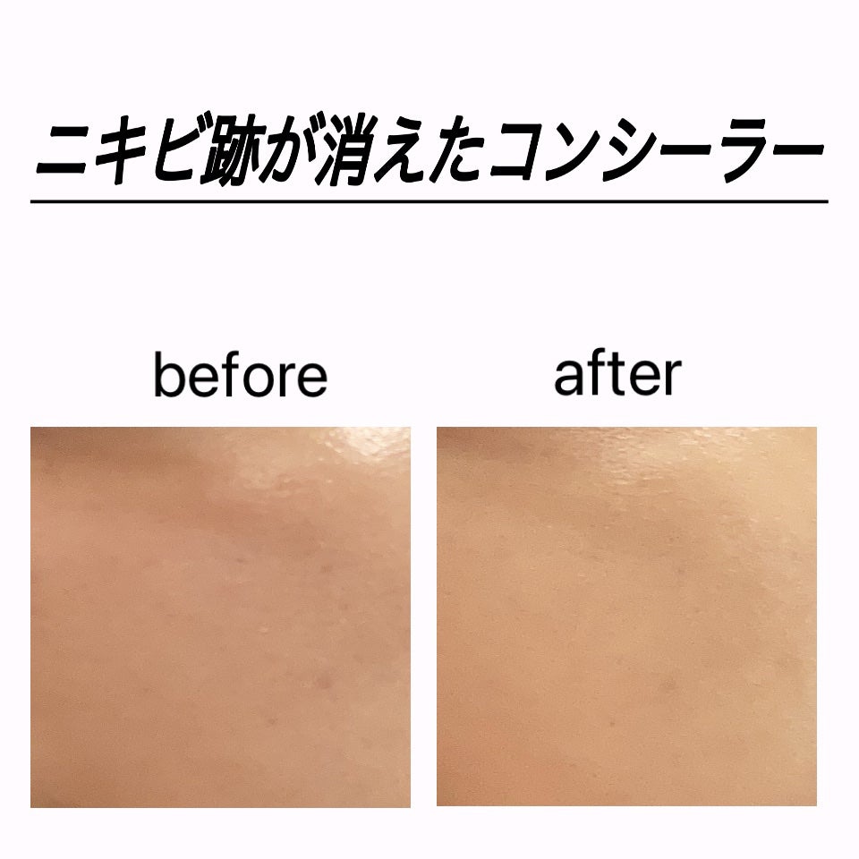 コンシーラー/coou/リキッドコンシーラーを使ったクチコミ(1枚目)
