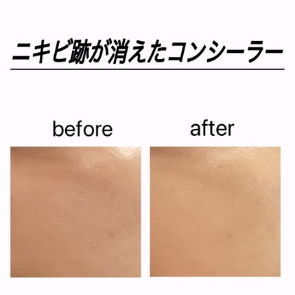 コンシーラー/coou/リキッドコンシーラーを使ったクチコミ(1枚目)
