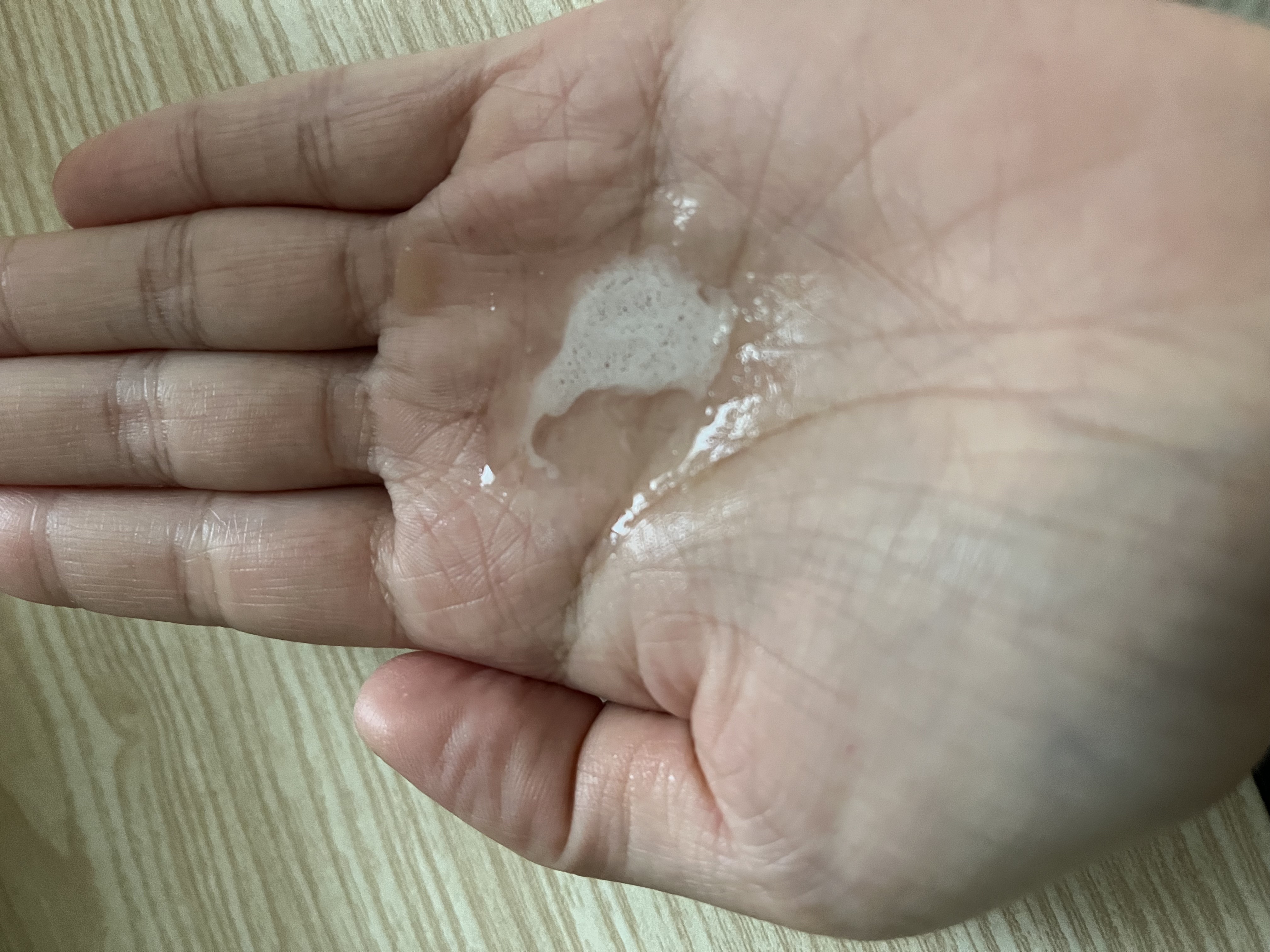 ふわ姫＜医薬部外品＞/ソーシャルテック/頭皮ローションを使ったクチコミ（3枚目）