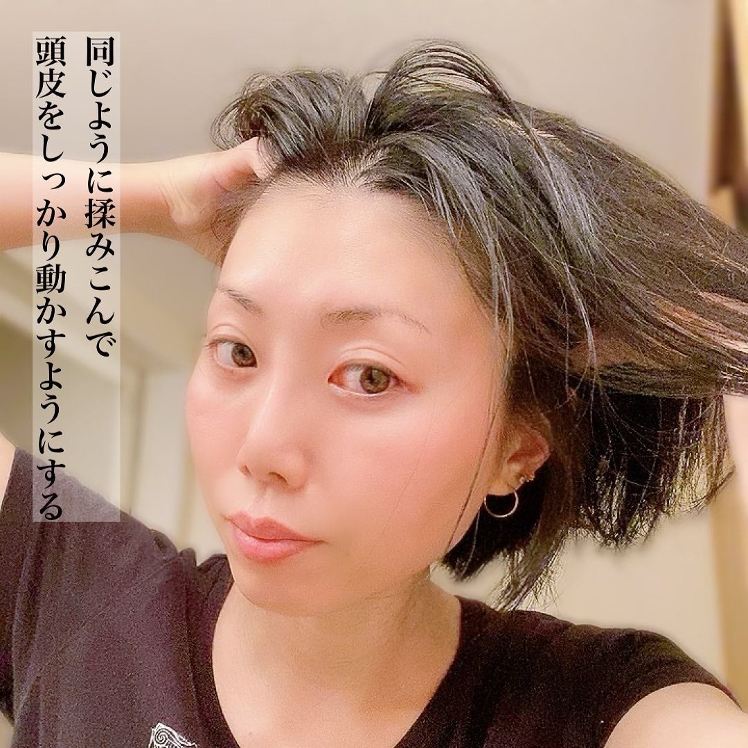 Wアプローチヘアプログラム/MUNOAGE(ミューノアージュ)/頭皮ローションを使ったクチコミ(6枚目)