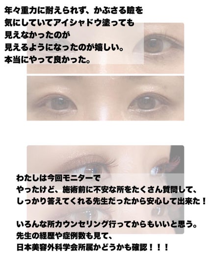 りっちゃん on LIPS 「土曜日の朝から目がたくさん出てきてすいません👀∞------..」(8枚目)