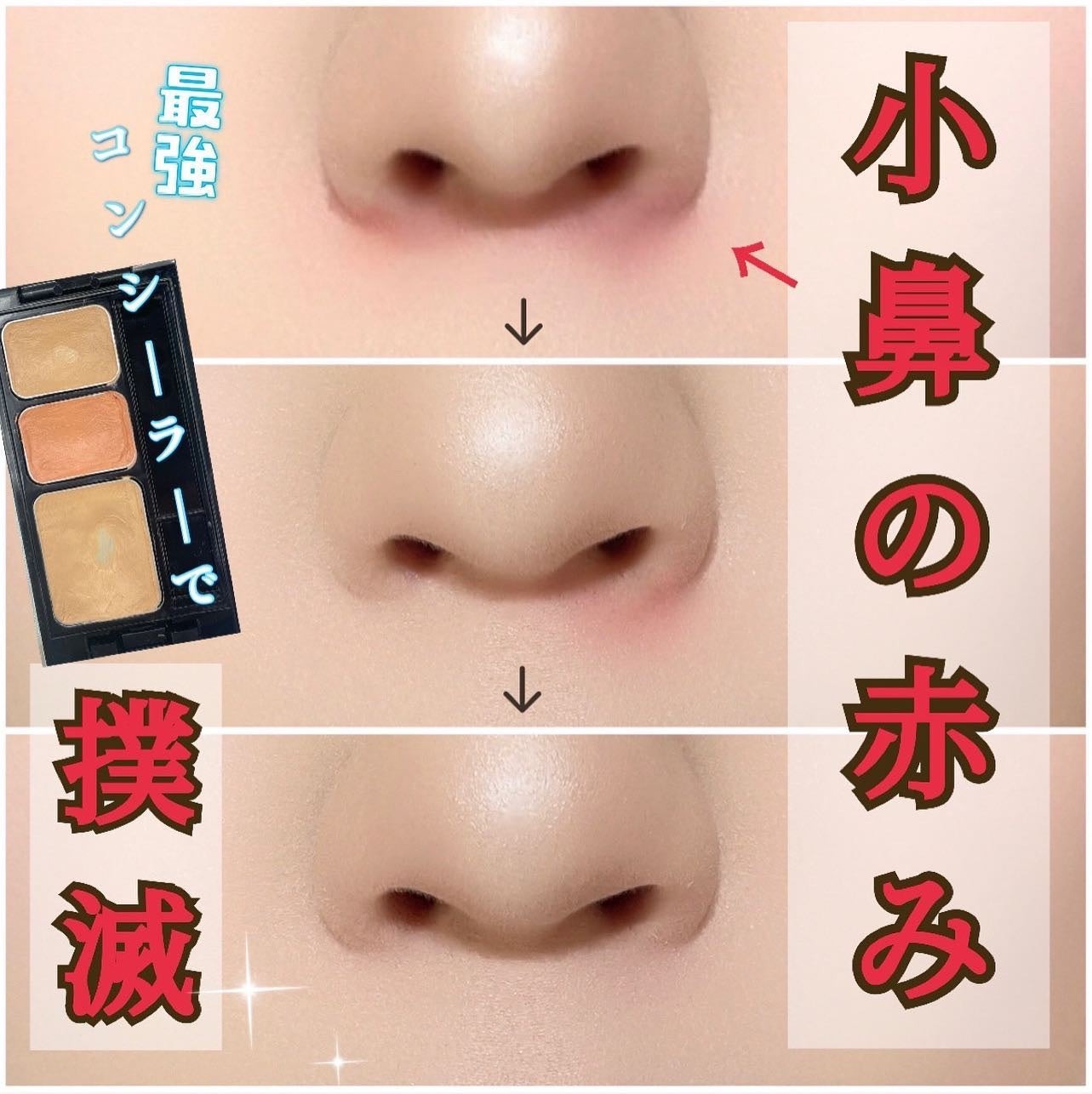 ミネラルコンシーラーパレット/エトヴォス/パレットコンシーラーを使ったクチコミ(1枚目)