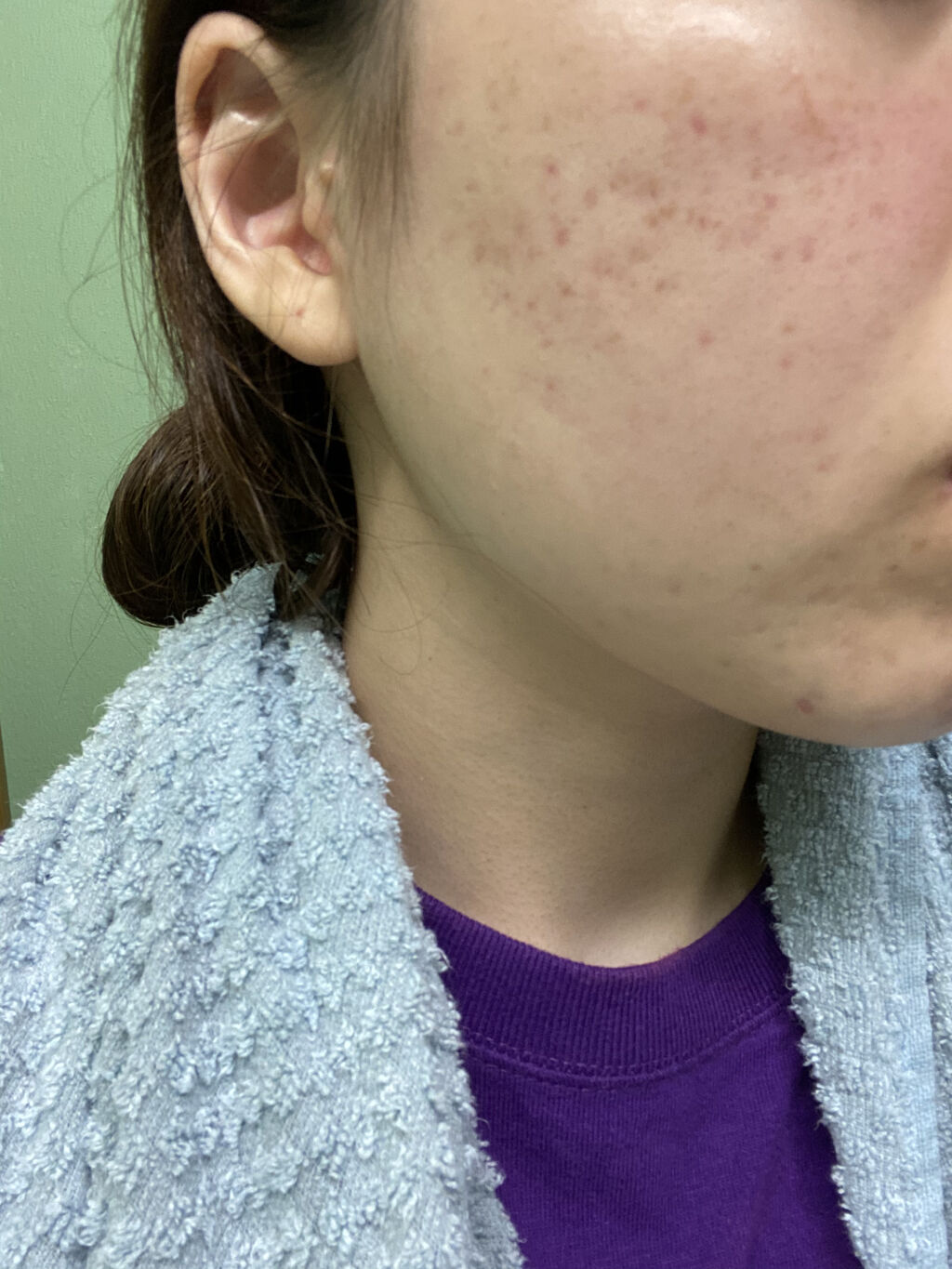 ブライト＆バウンシングローション（ノーマルタイプ）/ジュレリッチ/化粧水を使ったクチコミ（2枚目）