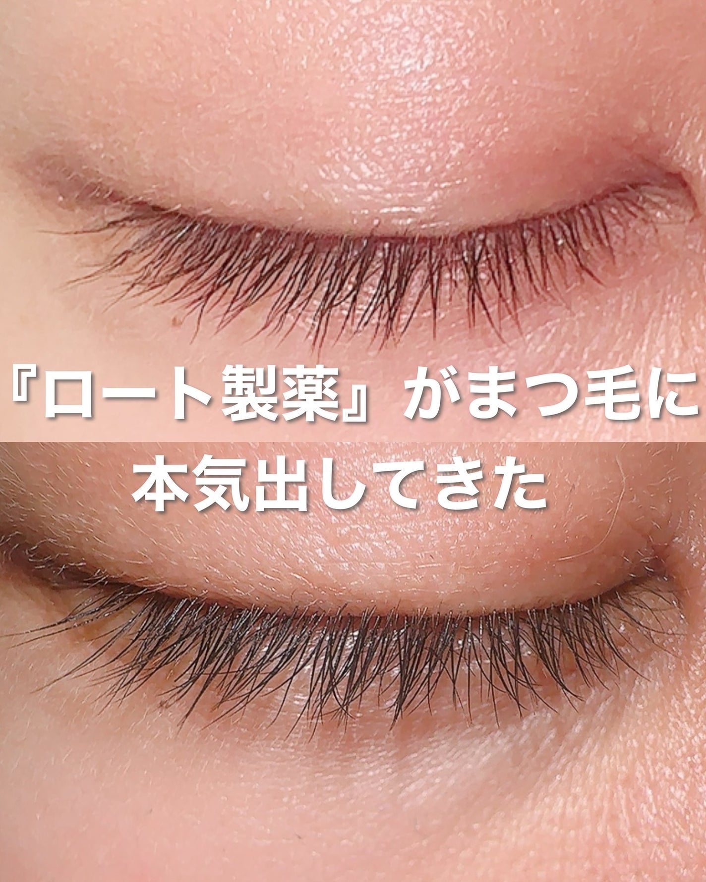 ラッシュリッチアイラッシュセラム/ロート製薬/まつげ美容液を使ったクチコミ(1枚目)