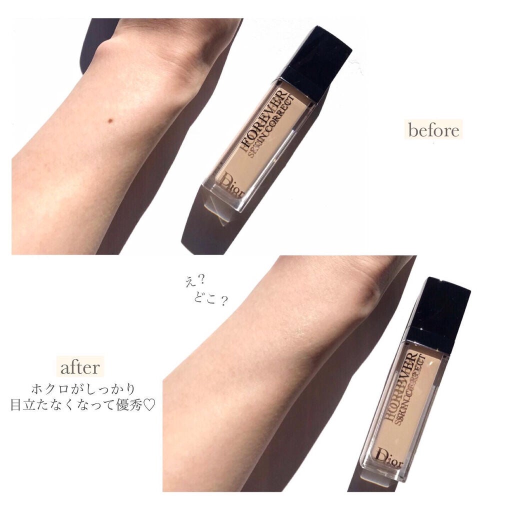 【旧】ディオールスキン フォーエヴァー スキン コレクト コンシーラー/Dior/リキッドコンシーラーを使ったクチコミ(2枚目)