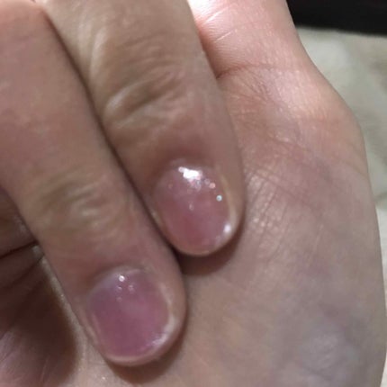 ネイルファンデーション/パラドゥ/マニキュアを使ったクチコミ(4枚目)