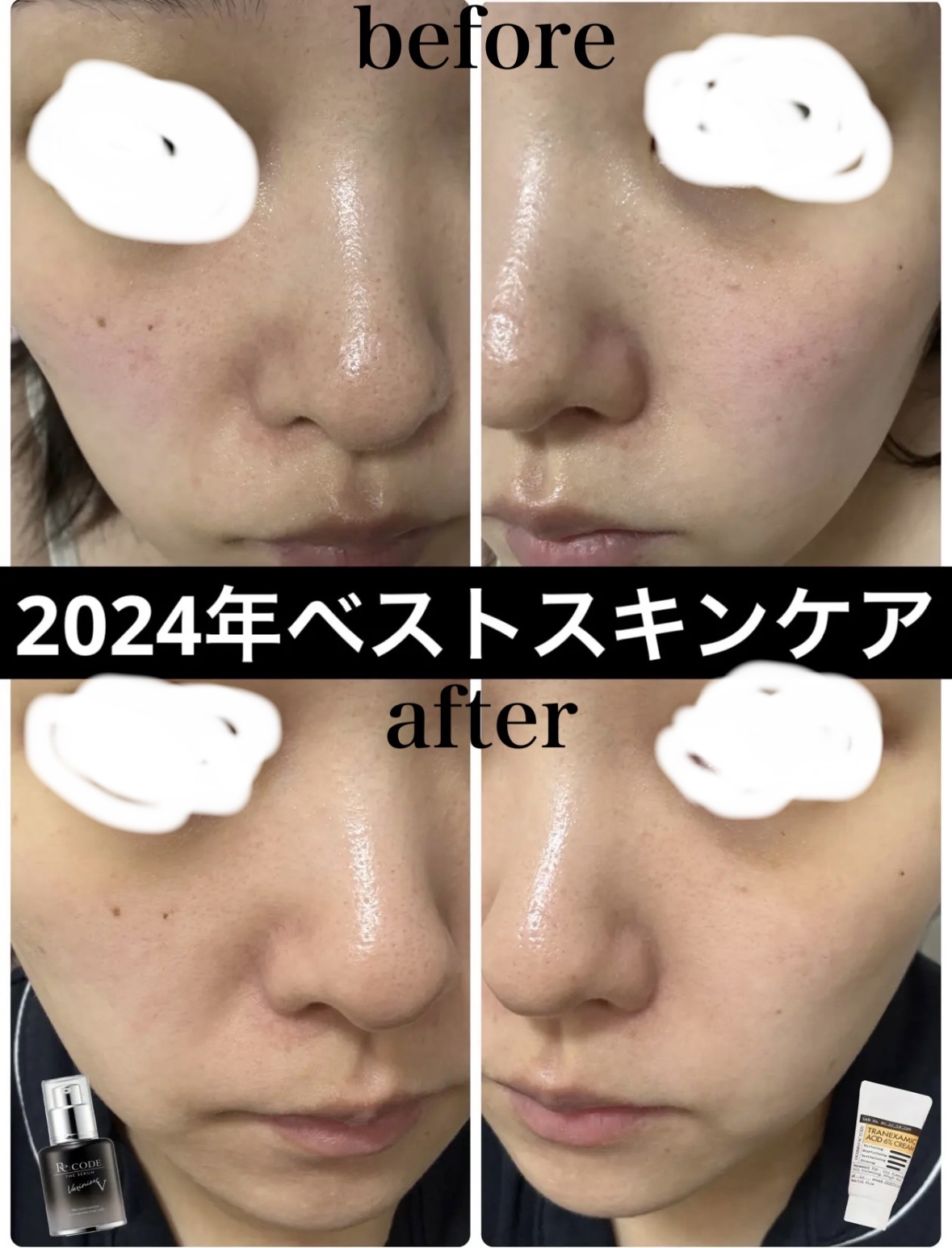 シミ・ソバカス予防ケア　フェイスクリーム/キュレル/フェイスクリームを使ったクチコミ（1枚目）