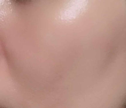 ゆき❅*° on LIPS 「こんばんゎ☽︎︎.*·̩͙今日のテーマは🌟5ヶ月で毛穴が目..」(3枚目)