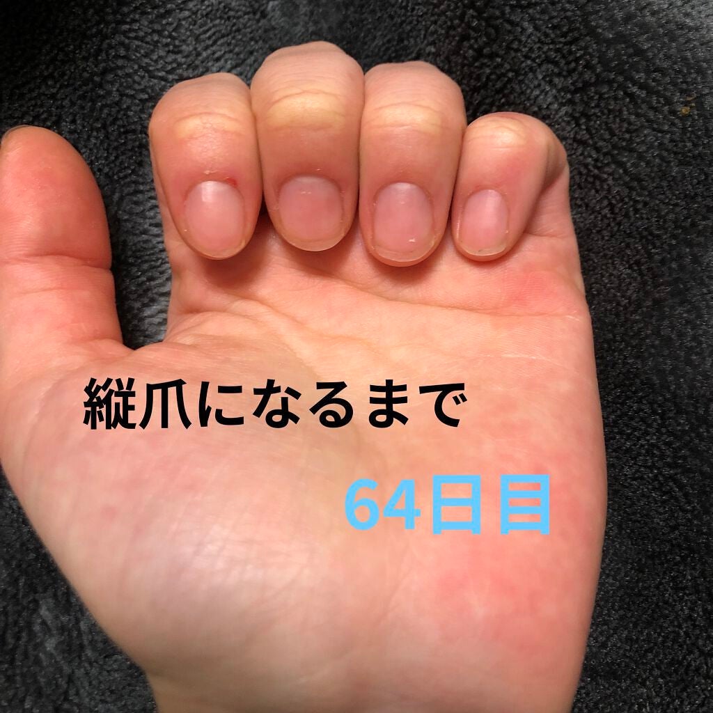 ð on LIPS ã瞊çªã«ãªãããã«ãããããªæ¹æ³ããã£ããæããŠãã ããðã¡ãªã¿..ãïŒ1æç®ïŒ