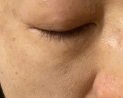 スキンリフレクト フレッシュ コンシーラー/ADDICTION/パレットコンシーラーを使ったクチコミ(4枚目)