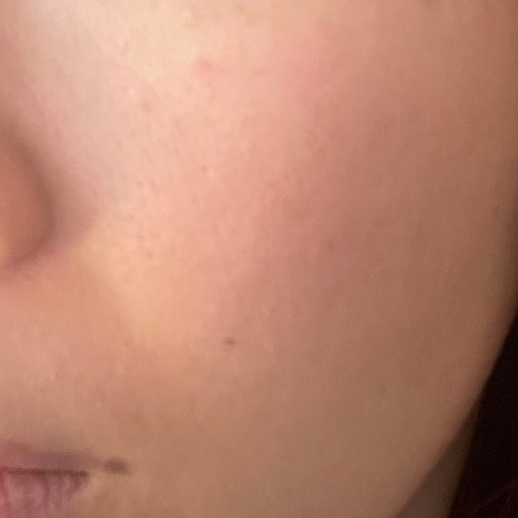 【旧】ディオールスキン フォーエヴァー フルイド グロウ/Dior/リキッドファンデーションを使ったクチコミ(2枚目)