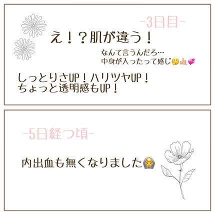 sayu on LIPS 「フィラークリニックで1番ベーシックな美白水光注射💉💙詳しくは画..」(5枚目)