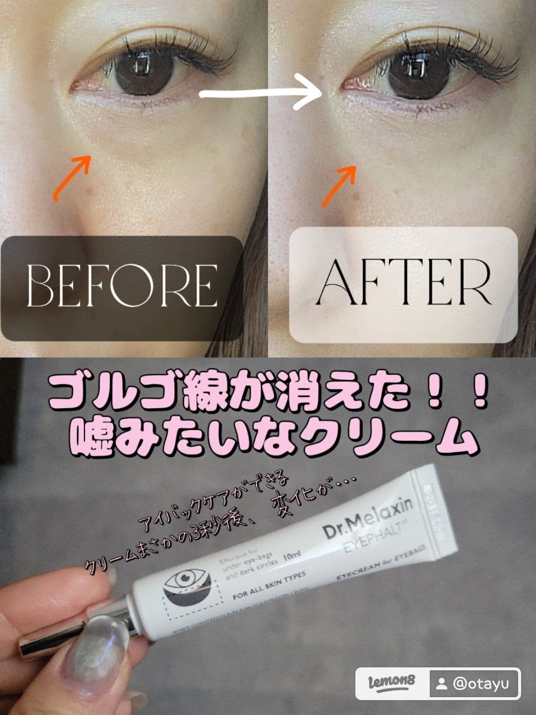 Cemenrete Calcium Intense Cream/Dr.Melaxin/フェイスクリームを使ったクチコミ(1枚目)
