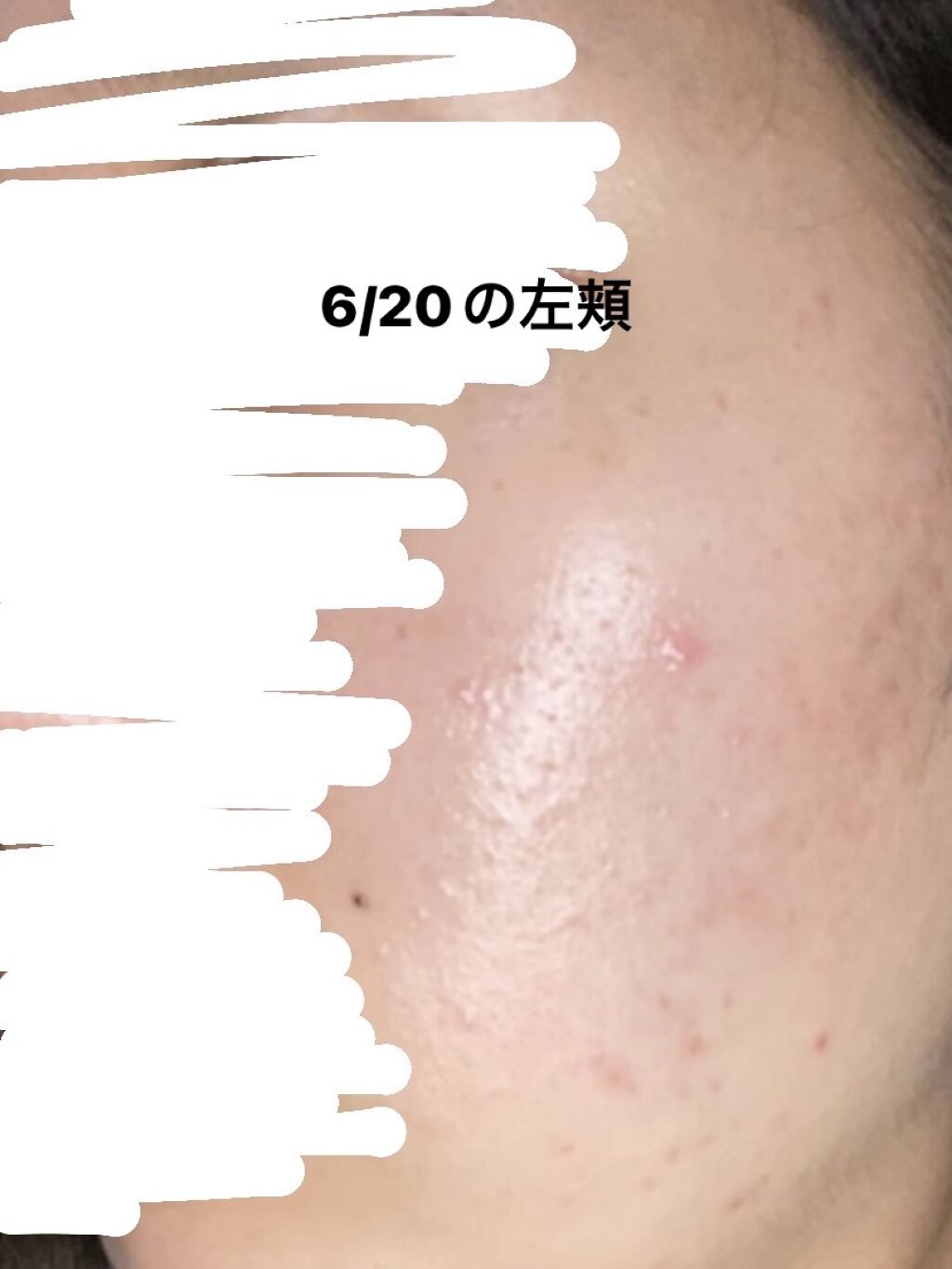 白潤 薬用美白乳液/肌ラボ/乳液を使ったクチコミ（3枚目）