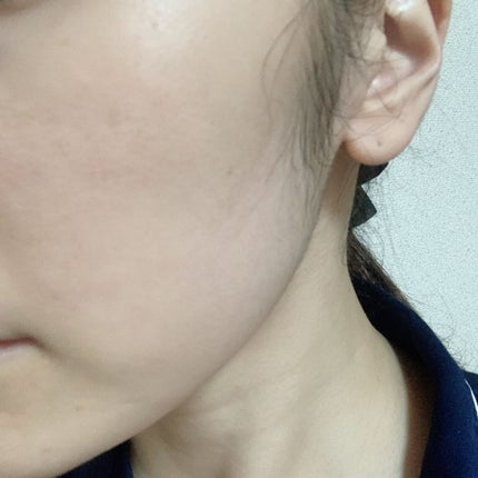 イドラクラリティ 薬用 トリートメント エッセンス ウォーター/DECORTÉ/化粧水を使ったクチコミ(5枚目)