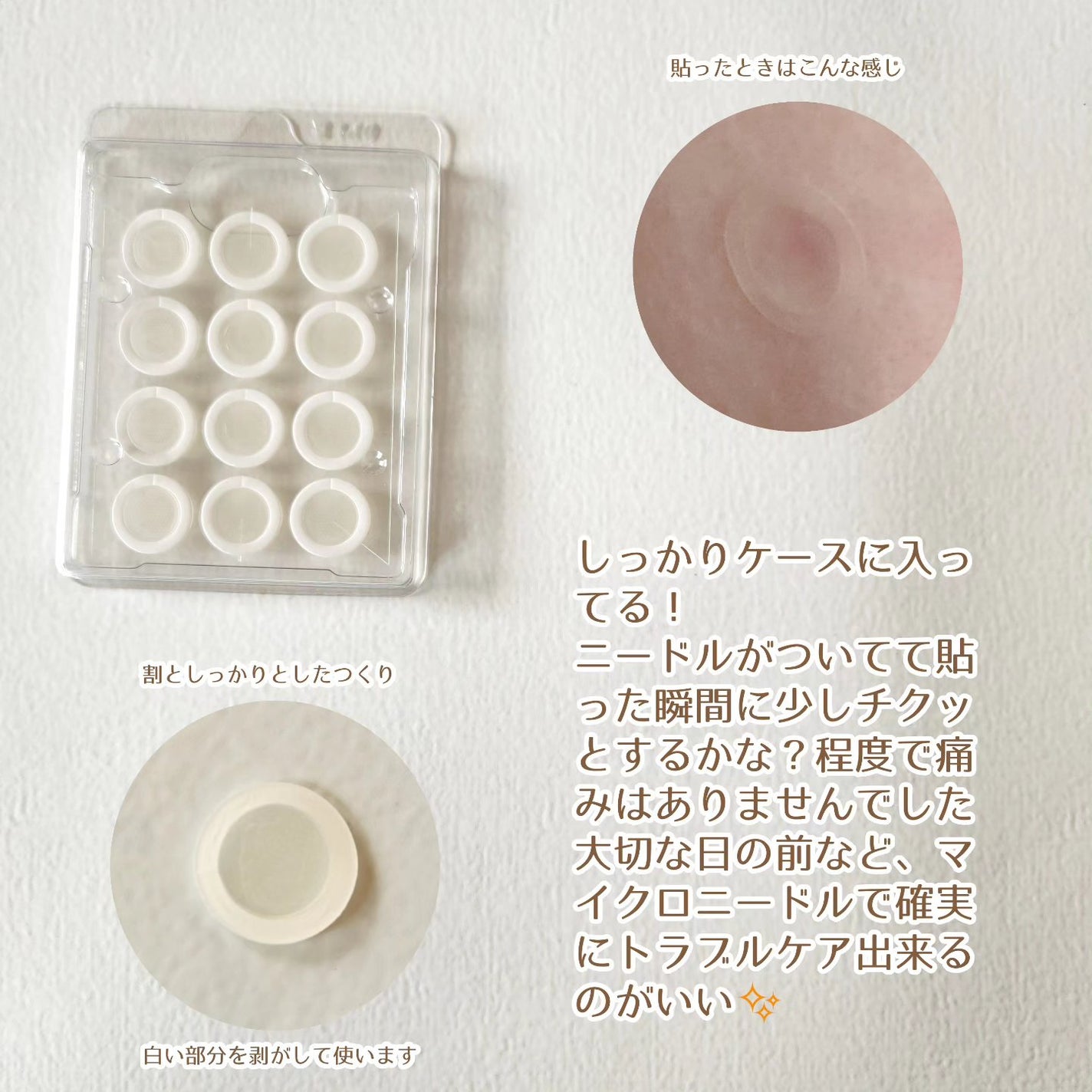 エーキュアショットスポットパッチ/obsero/にきびパッチを使ったクチコミ(2枚目)